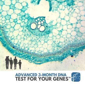 EVOLVE <br><strong>Test for Your Genes™</strong>